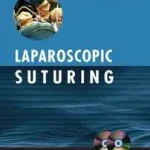 Laparoscopic Suturing byJain, Nutan; Expressz kézbesítés