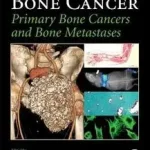 Bone Cancer byHeymann, Dominique; Gyors szállítás